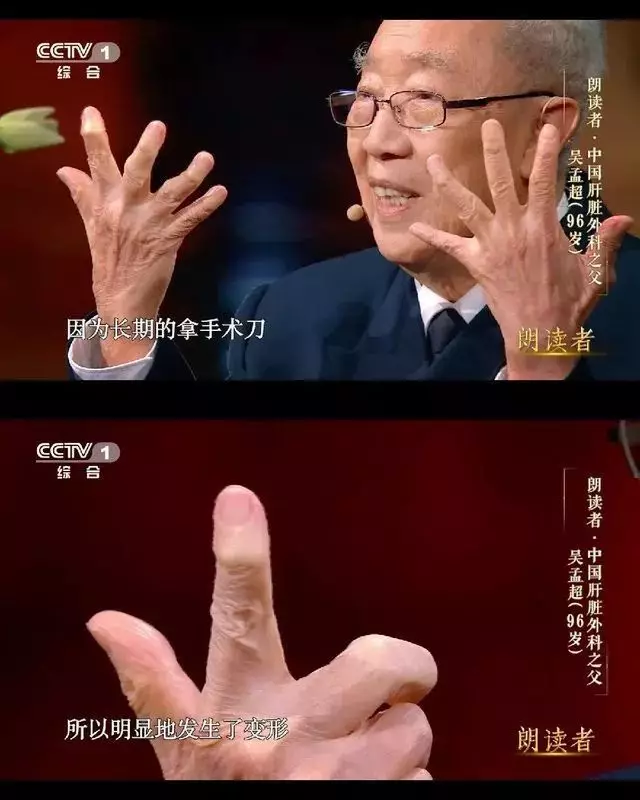 巨星陨落！吴孟超：如果有一天我要倒下去，就让我倒在手术室吧