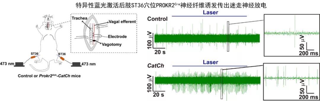 历史性突破！针灸研究登上Nature，哈佛华人学者为穴位存在提供现代神经解剖学基础