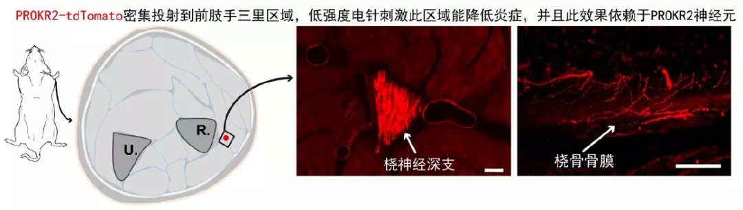 历史性突破！针灸研究登上Nature，哈佛华人学者为穴位存在提供现代神经解剖学基础